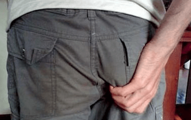 Juckreiz im Anus als Symptom für das Vorhandensein von Parasiten.