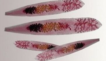 Opisthorchis-Parasiten im menschlichen Körper.