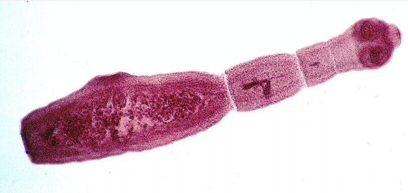 Echinococcus ist einer der gefährlichsten Parasiten für den Menschen. 