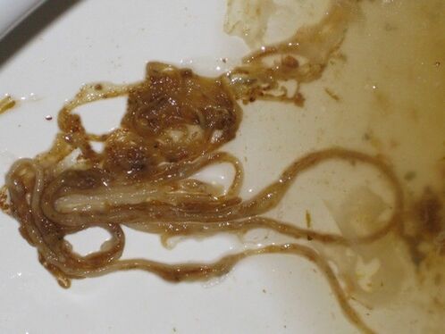 parasitäre Würmer des menschlichen Körpers