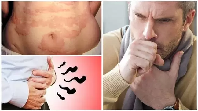 Allergien, Husten und Schwellungen sind Anzeichen für eine Schädigung des Körpers durch Würmer. 