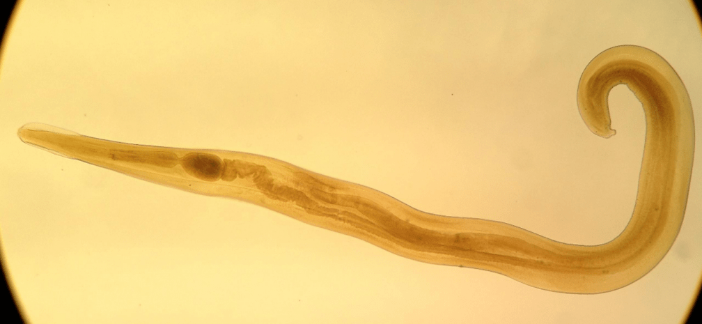 Madenwürmer sind ein häufiger Parasit bei Kindern. 