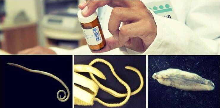 Arten von Würmern und medizinische Methoden, um sie loszuwerden. 